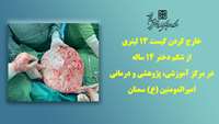 خارج کردن کیست 13 لیتری از شکم دختر 14 ساله در بیمارستان امیرالمومنین(ع)