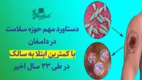 دستاورد مهم 1401 سلامت در دامغان با کمترین ابتلا به سالک در طی 23 سال اخیر