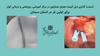 برای اولین بار در استان سمنان استنت گذاری دبل کیسه مجرای صفراوی در مرکز آموزشی، پژوهشی و درمانی کوثر انجام شد.