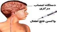 واکسن " پولیو تزریقی " به زودی  در برنامه واکسیناسیون قرارخواهد گرفت .