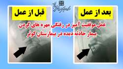 عمل موفقیت آمیز در رفتگی مهره های گردنی بیمار حادثه دیده در مرکز آموزشی، پژوهشی و درمانی کوثر سمنان
