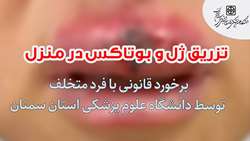 آماده سازی بوتاکس و ژل، در تشت حمام!!!