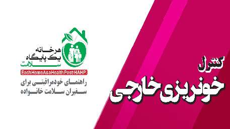  کنترل خونریزی خارجیکنترل خونریزی خارجی